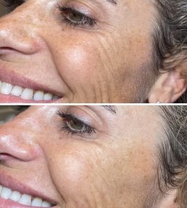 Skinvive Results