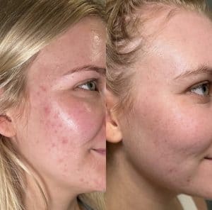 Face Reality Skin Transformation