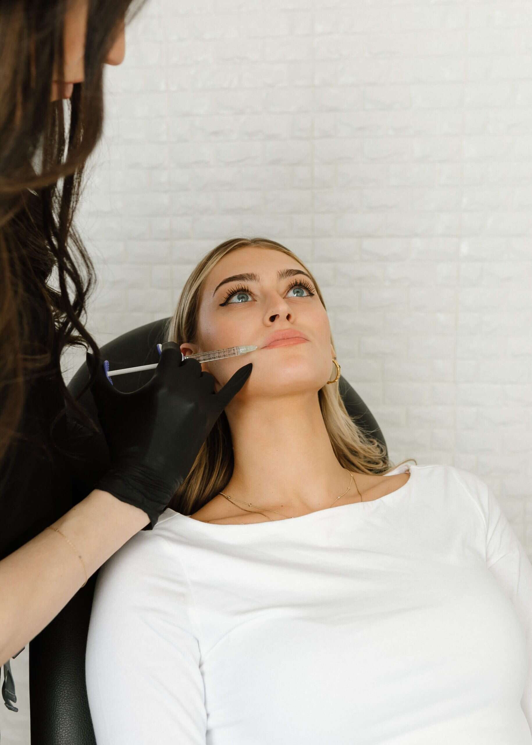 What Are the Different Swelling Stages of Lip Filler What Are the Different Swelling Stages of Lip Filler